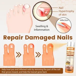 Ceoerty® NailRescue Bee Venom Spray